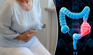Symptoms of Piles and Constipation - Causes of Piles and Constipation - Homeopathic Treatment for Piles and Constipation