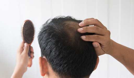 Hair Fall Treatment by N.P. Dutt & son